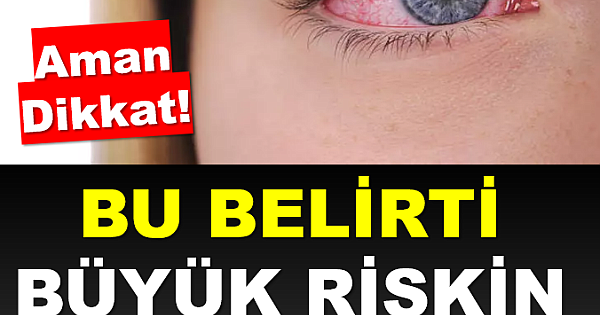 Riskin Uyarıcı İşareti!