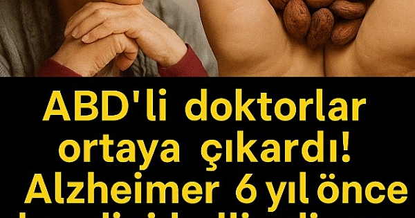 Alzheimer’ın bu 4 belirtisi genç yaşta 