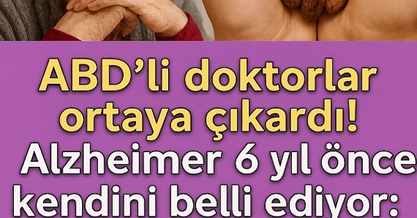 Alzheimer yıllar önceden belli oluyor