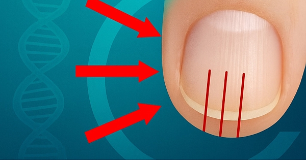 40'ından sonra bu çizgiler