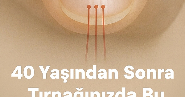 40 Yaşından Sonra Tırnaklarda Bu Çizgiler