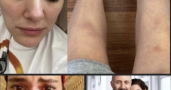 Başka ülkede yaşamaya başlayan Bergüzar Korel