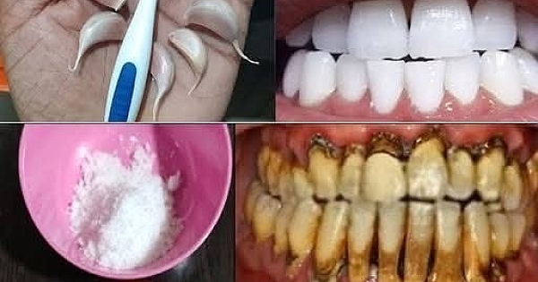 Diş Hekimlerinin bilmenizi istemediği sır 