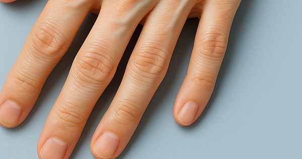 Eğer sizin de damarınız böyle ise