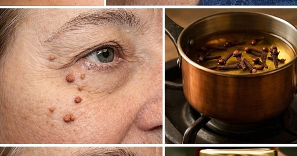 Et benlerinden kurtulmak 