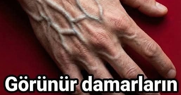 Görünür damarların manası buymuş meğer
