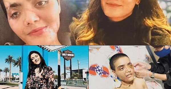 Henüz 25 yaşındaki Yaren Gürbüz’ün başına gelen 