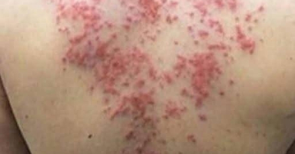 Uzmanlardan Şaşırtan Uyarı 