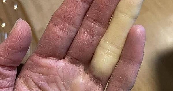 Uzmanlardan Şaşırtan Uyarı .