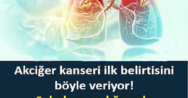 Akciğer Kanseri İlk Belirtisinii Böyle Gösteriyorr 