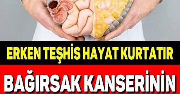 BU BELİRTİLER VARSA 