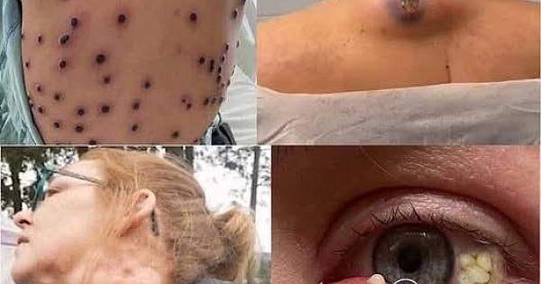 Bunlar onunla yatmanın sonuçları 