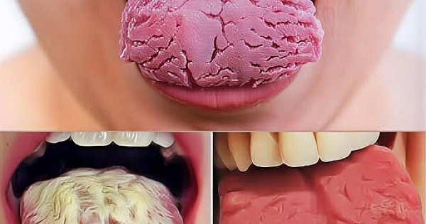 Dilinizin Sizi Uyarmaya Çalıştığı İşaret 