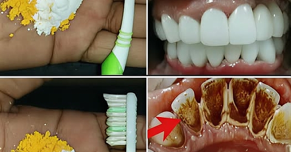Ev Diş Beyazlatma: Sadece 2 Dakikada 