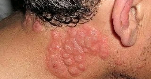 İşte onunla yatmanın sonuçları 