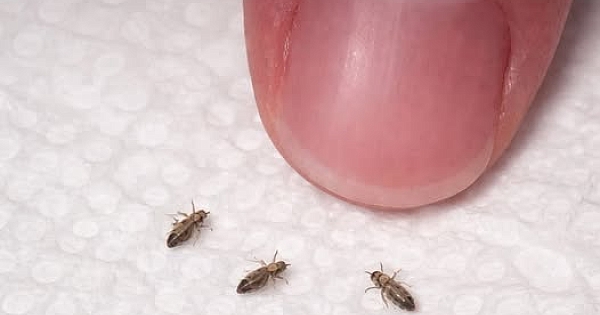 Saçını kontrol ederken bunu fark etti