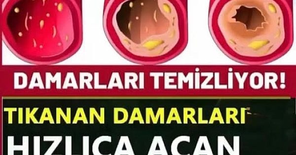 Damar Tıkanıklığını Önleyen Gıdalar 
