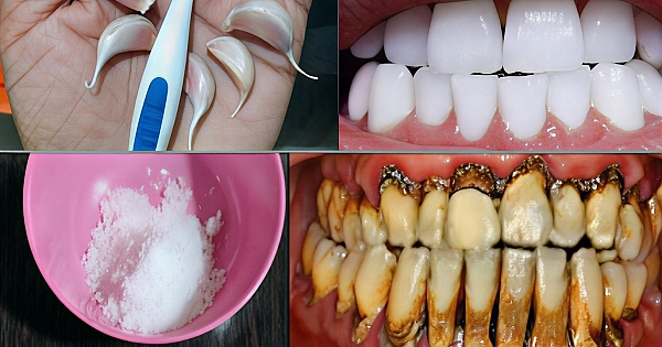 Diş Hekimlerinin bilmenizi istemediği sır 