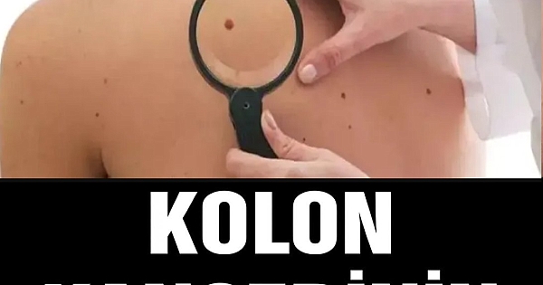 Kolon kanserinin en yaygın ve en kritik belirtileri