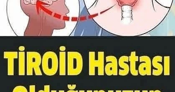 Tiroid Hastası Olduğunuzun 6 Saklı İşareti 