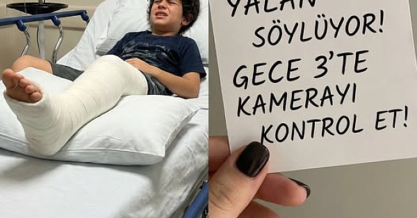 Oğlumun bacağı kırıldıktan sonra 