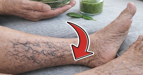 Bu karışım Doğal Olarak Destekler