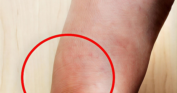 Bunlarla yatmanın sonuçlarıdır 