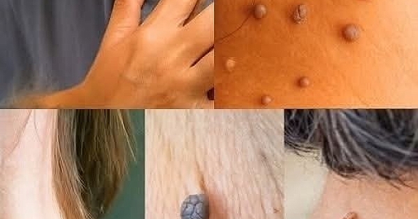 Evde 5 dakikalık tarif 