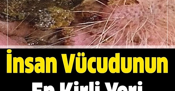 İnsan Vücudunun En Kirli Yeri Neresidir 