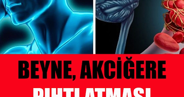 Pıhtı atması 