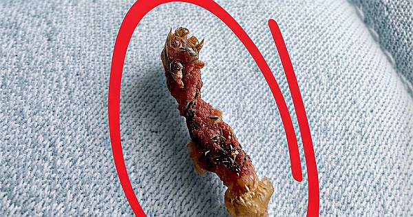 Uyandığımda sırtımın üst kısmında 