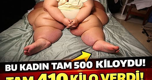 Yarım tonluk dünyanın en obez kadınıydı! 