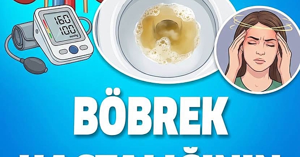 Böbrek Hastalıkları Çoğu Zaman Fark Edilmeden İlerliyor 