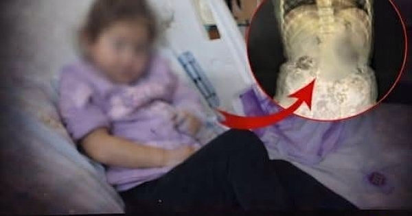 Karnı ve bağırsaklarından çıkanlar