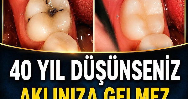 40 Yıl Düşünseniz Aklınıza Gelmez! 