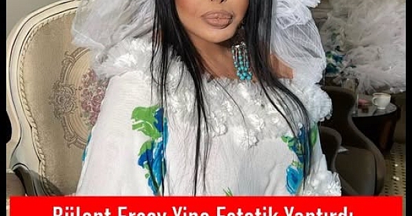 Bülent Ersoy estetik ameliyatı oldu 
