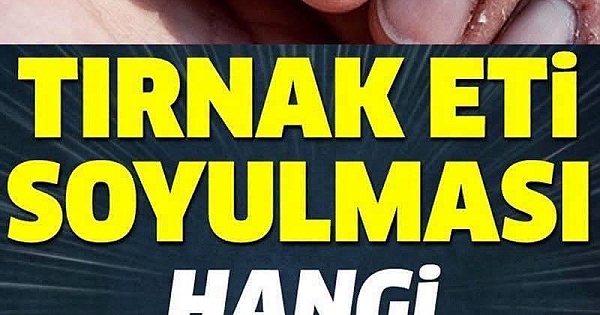 Tırnak eti soyulması