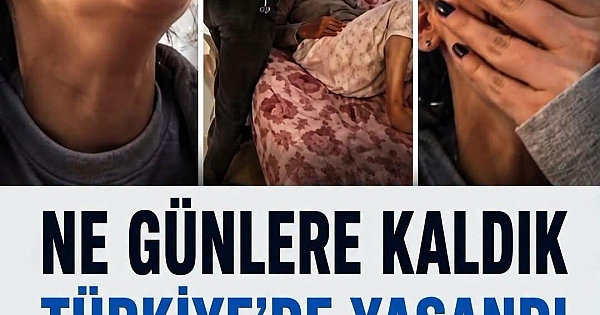 Türkiye’de Yaşandı Rezalet 