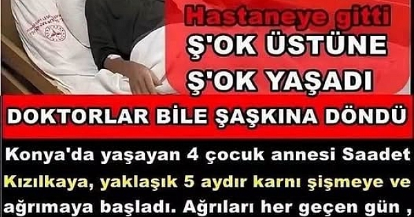 Karnım A'ğrıyor Diye Doktora Giden Kadının Karnından 