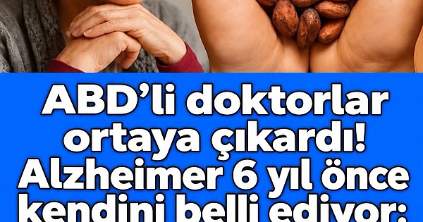 Alzheimerın bu 4 belirtisi 