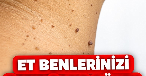 ET BENLERİNİ PATIR PATIR DÖKEN TARİF 
