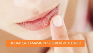 Dudak Çatlamasının 12 Sebebi Nedir? Çatlak Dudak Bakımı için Neler Önerilir?