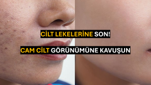 Cilt Lekelerine Son: Cam Cilt Sırrı